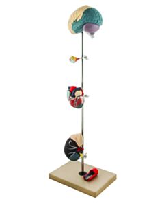 Eisco Labs Pathology Model, Hypertension, 7 Parts - Brain, Eye, 2 Part Heart, 2 Part Kidney