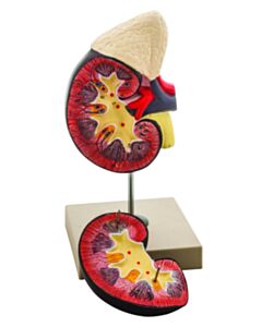 Eisco Labs Life-Size Human Kidney With Adrenal Gland Model, 2 Parts