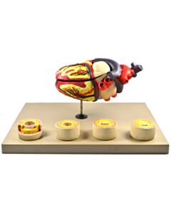 Eisco Labs Model Of Human Heart Conditions Pathology; Larger Than Life Size (10"); Artery