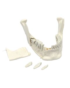 Eisco Labs Lower Jaw Model, 16 Extractable Teeth - Anatomically Accurate