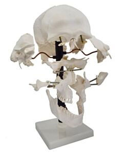 Eisco Labs Beauchene Exploded Skull Model - 13 Parts - Life Size - Mounted On Stand