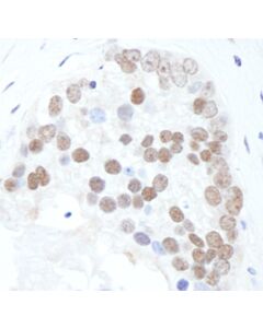 Bethyl Laboratories Rabbit Anti-Phospho Xrcc1 (S518/T519/T523) Antibody, Affinity Purified, Host: Rabbit, 10 µl (1000 µg/mL)