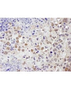 Bethyl Laboratories Rabbit Anti-Trim33/Tif1gamma Antibody, Affinity Purified, Host: Rabbit, Conjugate Type: Unconjugated, 10 µl (1000 µg/mL)