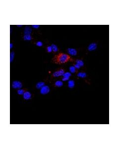 Millipore Anti-Timp-3 Antibody, Ct