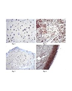 Millipore Anti-Mitofusin-2 (Mfn2) Antibody