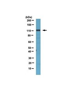 Millipore Anti-Phospho-Cyld Antibody (Ser418)