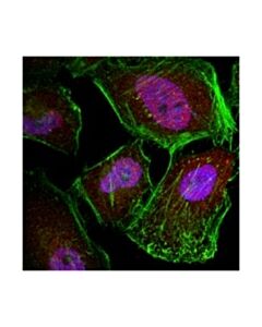 Millipore Anti-Caspase 3 Antibody