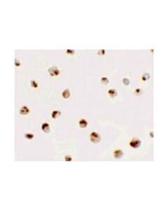 Millipore Anti-Sdhd Antibody