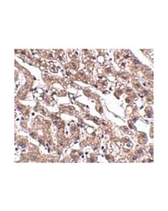 Millipore Anti-Macc1 Antibody