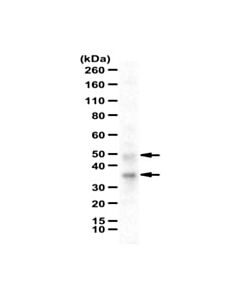 Millipore Anti-Fcrn/Fcgrt Antibody