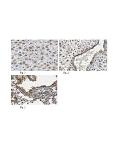 Millipore Anti-Bst2 Antibody