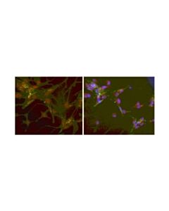 Millipore Anti-Fibroblast-Specific Protein 1 (S100a4) Antibody