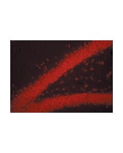 Millipore Donkey Anti-Mouse Igg Antibody, Rhodamine Conjugate, Species