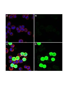 Millipore Anti-Adenovirus 1,2,5,6 Antibody, Clone 7/48.7c