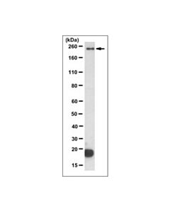 Millipore Anti-Dysferlin/Dysf Antibody, Clone 10h3.1