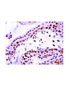 Millipore Anti-Insulin Receptor Antibody, Beta Subunit, Clone Ct-3