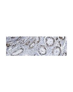 Millipore Anti-Podoplanin Antibody, Clone Lpmab-13