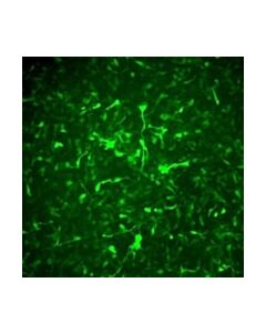 Millipore Alzheimers In A Dish Appsl-Gfp Lentivirus