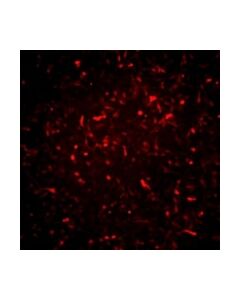 Millipore Alzheimers In A Dish Psen1-RFP Lentivirus