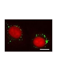 Millipore Biotracker Lyso-Tp Live Cell Dye