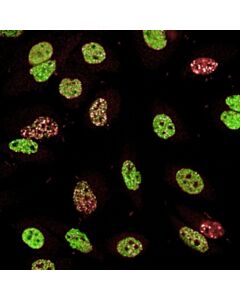 Revvity PhenoVue DNA Damage Response Staining Kit (γ-H2AX, 53 BP1), 1x384