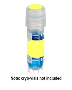 RPI Direct Thermal Cryo-Tags (1.5x0.5")And Spot (3/8") Combo, Yellow, 500 Sets Per Package