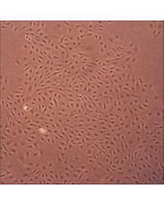 Sigma-Aldrich Porcine Pulmonary Artery Endothelial Cells: Ppaec