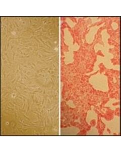 Sigma-Aldrich Rat Pulmonary Artery Smooth Muscle Cells: Rpasmc, A