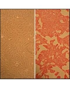 Sigma-Aldrich Rat Aortic Smooth Muscle Cells: Raosmc, Adult