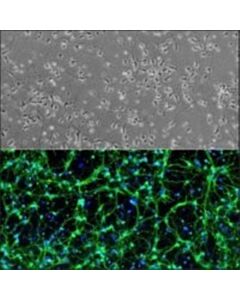 Sigma-Aldrich Rat Midbrain Neurons: Rmbn