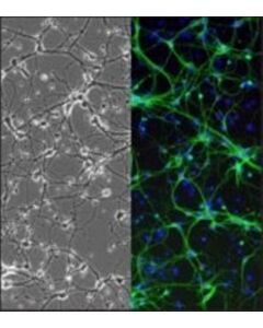 Sigma-Aldrich Rat Striatal Neurons: Rstn