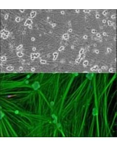 Sigma-Aldrich Rat Dorsal Root Ganglion Neurons: Rdrgn