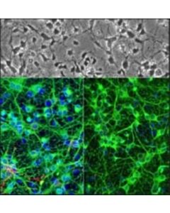Sigma-Aldrich Rat Hippocampal Neurons: Rhin