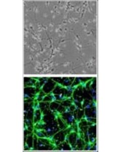 Sigma-Aldrich Rat Hindbrain Neurons: Rhbn