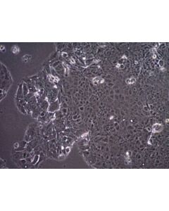 Sigma-Aldrich Mcf-7/S0.5 Human Breast Cancer Cell