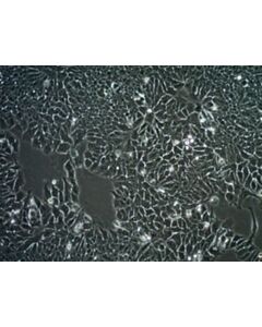 Sigma-Aldrich Mcf-7/Tamr-1 Human Breast Cancer Cel